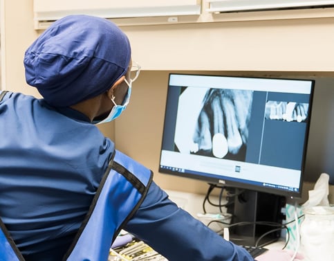Dental professional looking at x-ray to see what the course of treatment will be for the patient