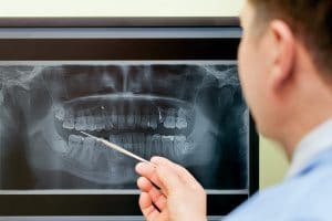 Dentist examining x-ray of patient's mouth before sending claim to clearinghouse