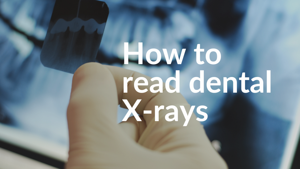 how-to-read-dental-x-rays