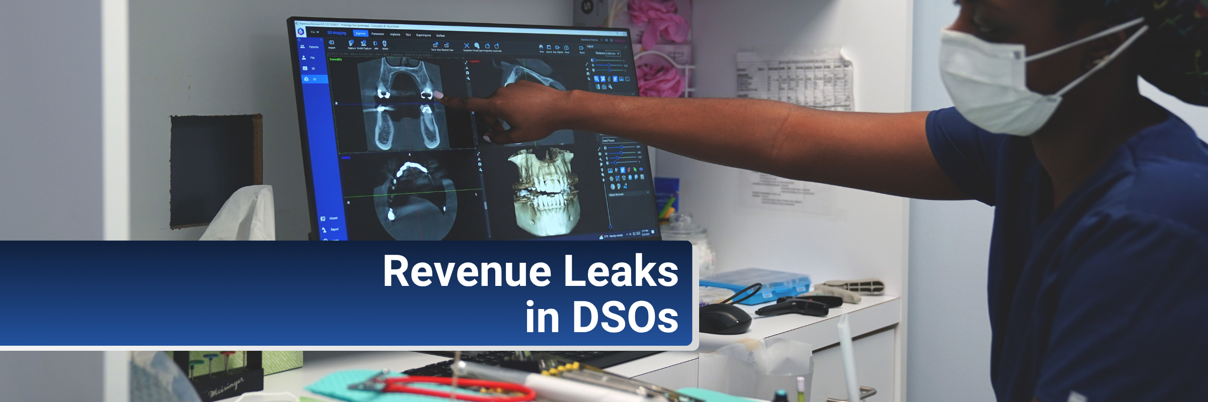 Revenue leakage in DSOs: The hidden cost of different billing processes